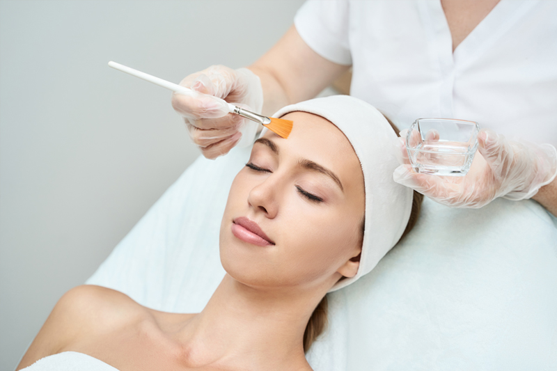 Consider a Chemical Peel in Wilmington
