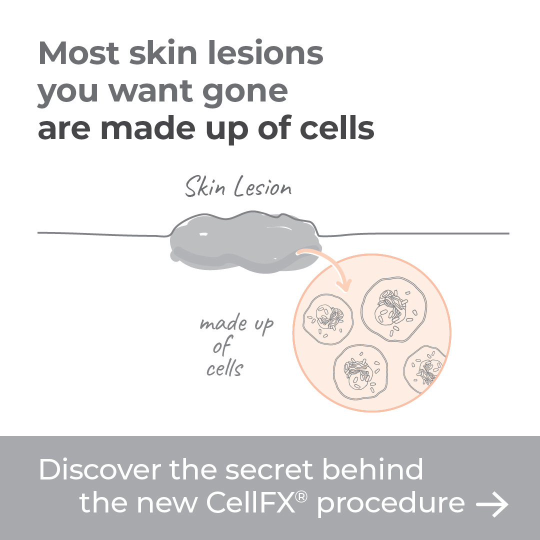 CellFX at Wilmington Dermatology Center