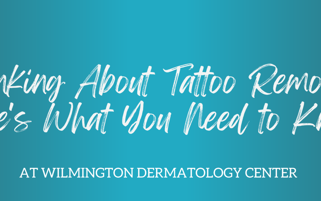 Thinking About Tattoo Removal? Here’s What You Need to Know