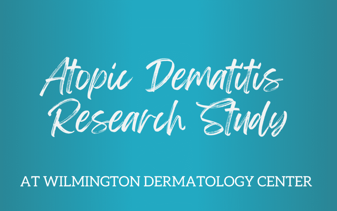 Atopic Dematitis Research Study